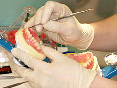 義歯治療22