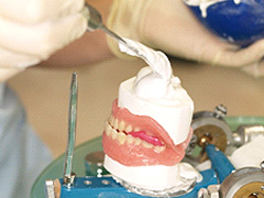 義歯治療25