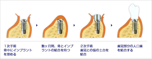 CvgÎ菇摜